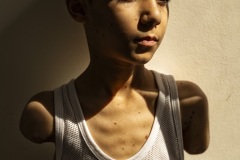 Mahmoud Ajour, 9 years old, lost both hands after being hit by a missile from Israeli warplanes during the war on Gaza, in Doha, Qatar, June 28, 2024.

A portrait project on wounded Gazans in Doha. 

Story summary:
Amputations. Disfiguration. Brain damage. Their injuries are life-changing.

Badly wounded Gazans survived a war that has killed tens of thousands. They made it out for medical treatment in Qatar, where we photographed and interviewed them.

They are alive — even if some are not sure they still want to be.

World Press Caption:
Mahmoud Ajjour, 9.

Mahmoud’s family fled their home after Israeli shells began falling. The going was slow, and the boy went back to urge everyone on. When an explosion ripped off one hand and mangled the other, his pleas changed. He asked to be left behind, saying: “I am going to die.” In Qatar, Mahmoud is using his feet for everything. “My biggest wish now is to get prosthetics,” he says.